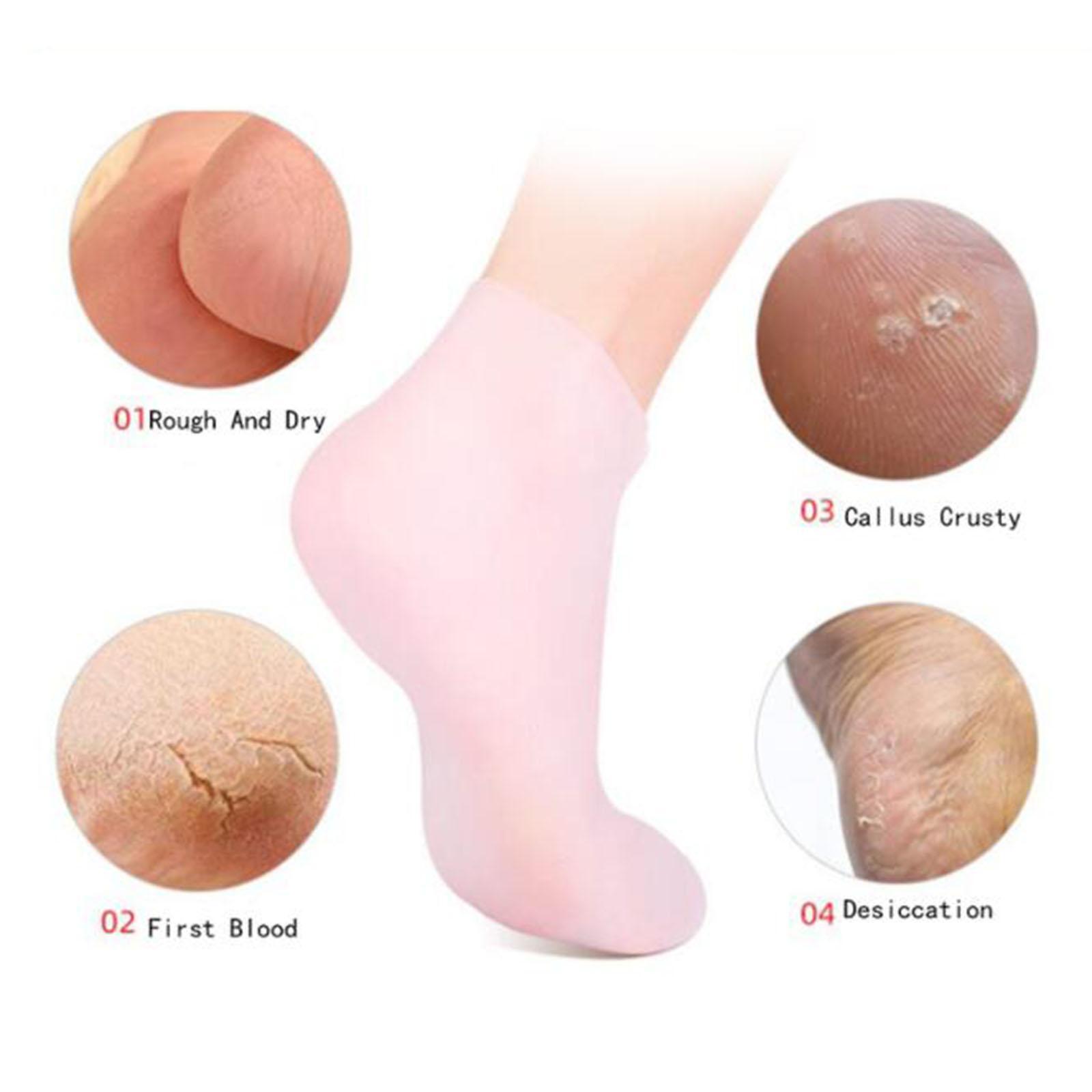 Soft Silicone Gel Socks Toe So - Xl Skincare ulasan dan harga