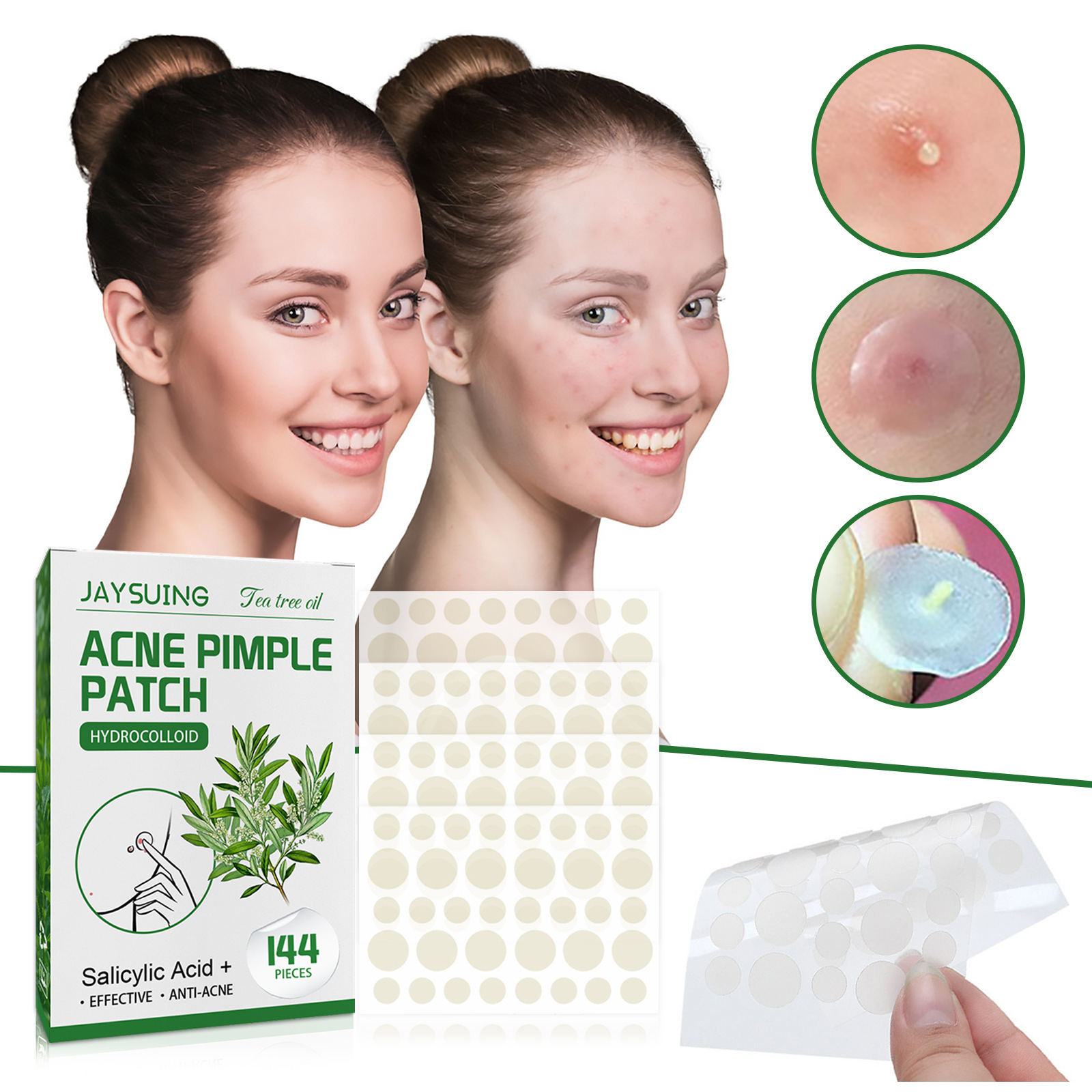 Hydrocolloid Acne Patches - Ab - Skincare The Originote ulasan dan harga