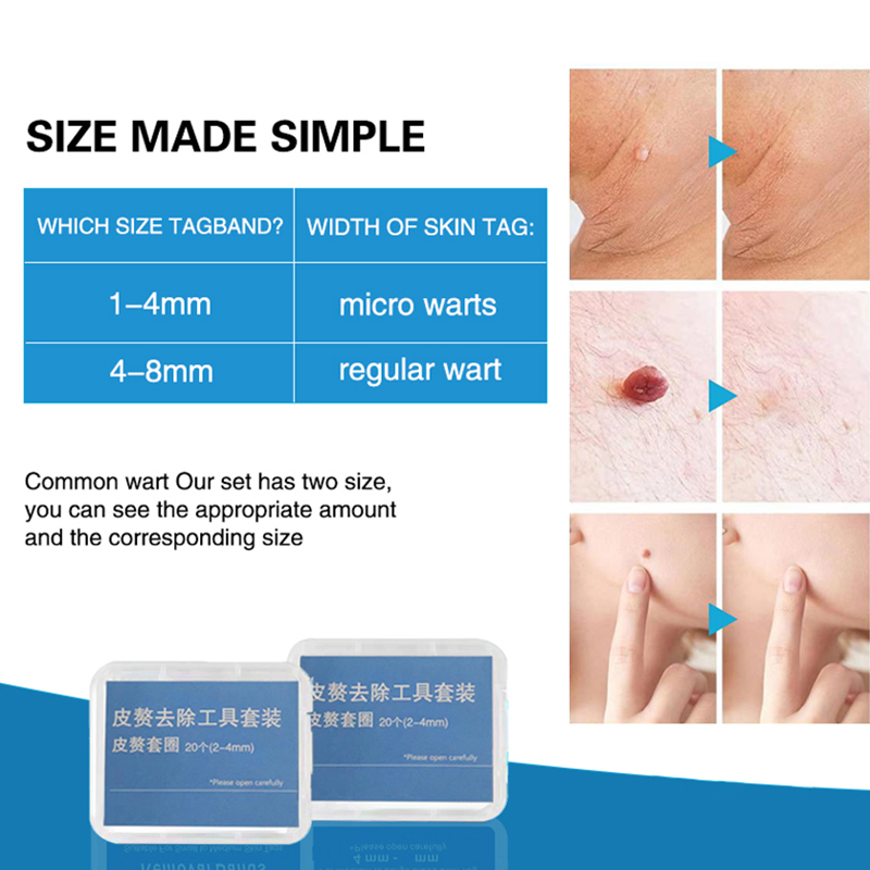 20pcs/Box Flesh Nevus Removal  - Skincare Qv ulasan dan harga